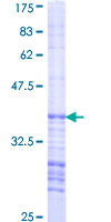 12.5% SDS-PAGE Stained with Coomassie Blue.